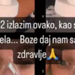 ZABRINULA FANOVE! Luna Đogani otkrila da joj je narušeno zdravlje, poručila samo jedno
