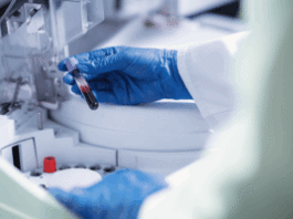 bec:-razvijen-prvi-test-za-rano-otkrivanje-multiple-skleroze-–-nedeljnik