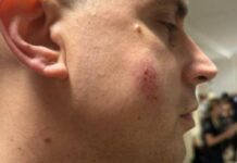 raste-broj-povredjenih-policajca-u-pancevu!-jedan-gadjan-kamenom-u-glavu-–-jezivo-(foto)